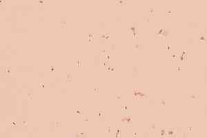 Линолеум Forbo Sphera Energetic 50231 rosebud фото  | FLOORDEALER